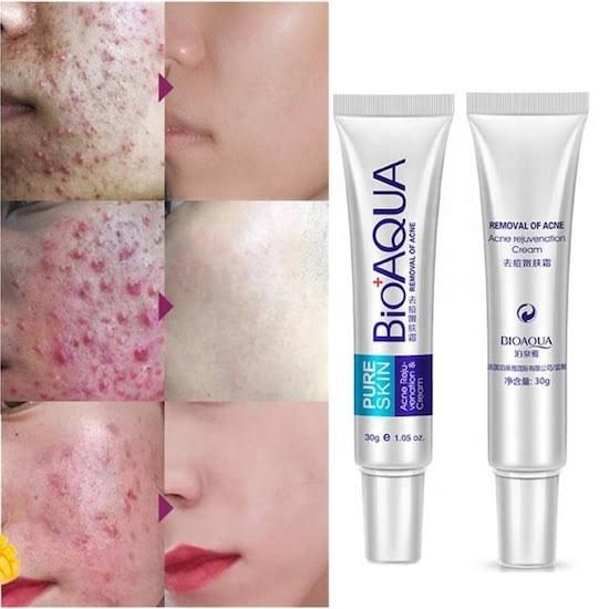 CREMA ANTIACNÉ - Imagen 2